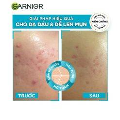 Serum Garnier Bright Complete Anti-Acnes Booster 30ml