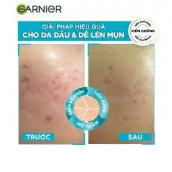 Serum Garnier Bright Complete Anti-Acnes Booster 30ml